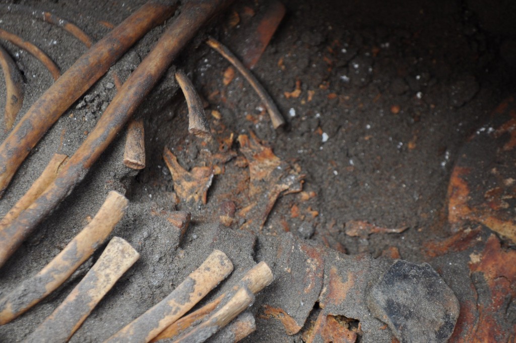 Primo piano dell'addome della sepoltura CNS U2-60 da Eten, Perù. Resti di un teratoma ovarico sottoforma di piccole chiazze tra la gabbia toracica e il bacino. (Foto: H. Klaus)