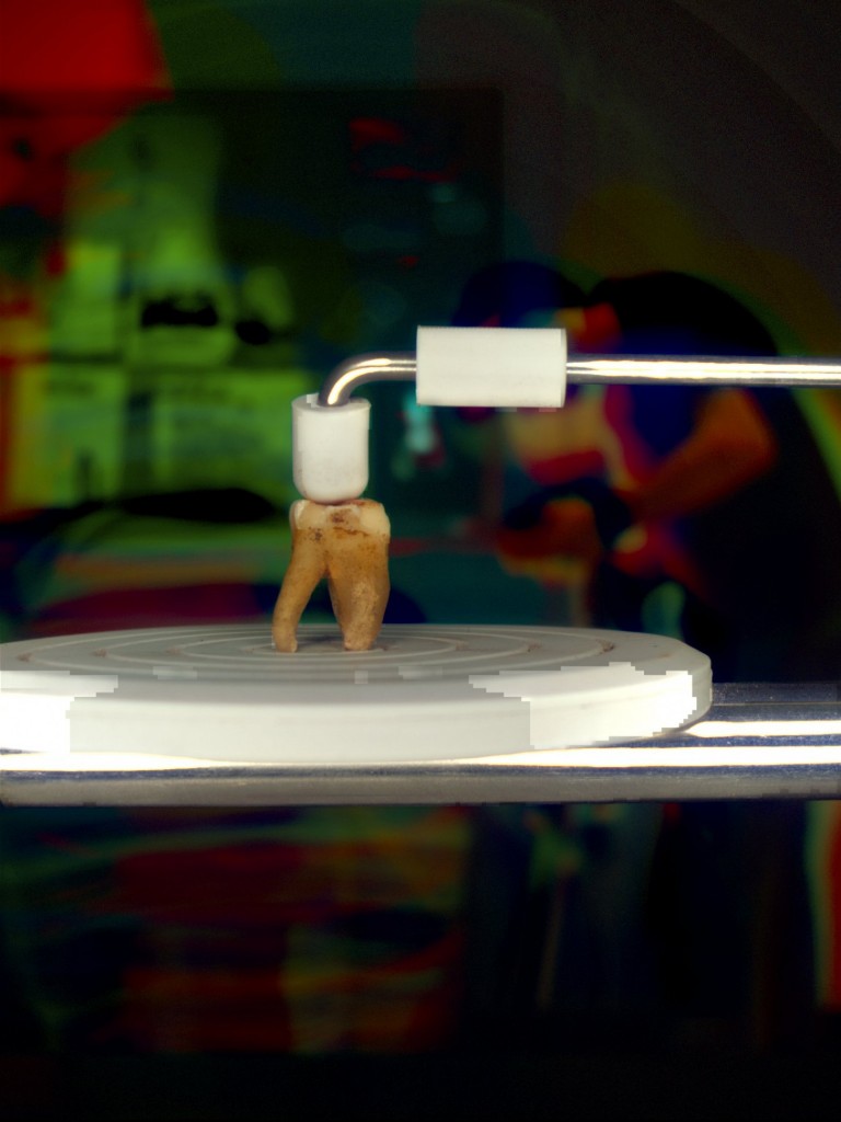 Utilizzazione di uno scanner NextEngine 3D per digitalizzare un molare dal sito medievale di Berlino Petriplatz. (Foto: K. Killgrove)